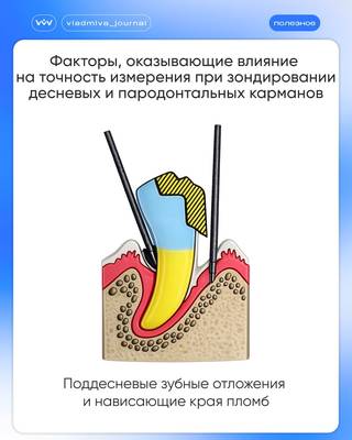 Памятки стоматолога: сохраните здоровье улыбки.